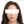 顔面非対称の矯正（顔の左右差修正） — 術前 (10日) · オリンピック123韓方クリニック