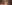二重まぶた（自然癒着法） — アイフィット美容外科クリニック