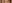 裏ハムラ法（経結膜的眼窩脂肪移動術） — エスエイチ美容外科クリニック(SH美容外科クリニック)