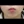 Chin botox (mentalis muscle botulinum toxin) — before · Doctor Petit Clinic - Incheon Guwol Branch