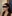 Platysma plication (corset platysmaplasty for double chin/jawline) — Dasipium Plastic Surgery Clinic