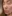 鼻尖形成術（鼻尖縮小） — ドクター美美容外科クリニック