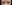 二重まぶた（自然癒着法） — ハニー美容外科クリニック