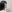鼻尖形成術（寄贈軟骨使用） — セギム美容外科クリニック
