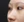 ผ่าตัดเอาสิ่งแปลกปลอมออกจากจมูก (เอาซิลิโคนจมูกออก) — หลังทำ (30วัน) · คลินิกศัลยกรรมตกแต่งอีเอสชองดัม