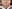 Facial liposuction — Jerim Plastic Surgery Clinic