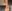 Nasal tip surgery (tipplasty) — Haibom Plastic Surgery Clinic