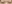 二重まぶた（自然癒着法） — イエロー美容外科クリニック