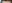 額縮小術（生え際下げ・ヘアライン下降術） — ザフィックス美容外科クリニック
