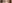 二重まぶた（自然癒着法） — フルルン美容外科クリニック