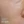 RevLite SI (Q-switched Nd:YAG laser toning) — after (60days) · A-Top Plastic Surgery Clinic