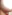 二重あごの脂肪吸引（顎下脂肪吸引） — アウラ美容外科クリニック