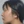 Oligio / Oligio X (โอลิจิโอ) — หลังทำ (30วัน) · คลินิกศัลยกรรมพลาสติก LaVian