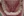 จัดฟันเฉพาะส่วนด้านใน 2D (2D lingual partial braces) — ก่อนทำ (126วัน) · คลินิกทันตกรรม Lucent
