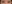 二重まぶた（自然癒着法） — アーバン美容外科クリニック