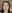 スキンボトックス（マイクロボトックス） — ホンデセレナクリニック