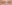裏ハムラ法（経結膜的眼窩脂肪移動術） — プレジャー美容外科クリニック