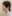 二重あごの脂肪吸引（顎下脂肪吸引） — ディユ美容外科クリニック