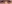 裏ハムラ法（経結膜的眼窩脂肪移動術） — エイペックス美容外科クリニック