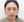 Paranasal (nasal base) augmentation with implant — before (50days) · iLumi Plastic Surgery Clinic