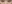 裏ハムラ法（経結膜的眼窩脂肪移動術） — プレジャー美容外科クリニック