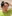 Revision facial contouring surgery (secondary facial bone surgery) — WHY Oral and Maxillofacial Surgery & Dental Clinic