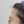 โบท็อกซ์หว่างคิ้ว — ก่อนทำ · คลินิกเดอะอิบพ์