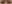 涙袋ヒアルロン酸注入（涙袋形成） — フルルン美容外科クリニック