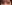 二重まぶた（自然癒着法） — プロミス美容外科クリニック