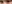 目尻切開 — フルルン美容外科クリニック