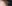 生え際の植毛（ヘアライン植毛） — バンスモザイナークリニック