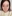 裏ハムラ法（経結膜的眼窩脂肪移動術） — ジャスト美容外科クリニック