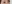 目尻切開 — プロミス美容外科クリニック