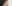 顔の脂肪注入（自家脂肪移植） — オメガ美容外科クリニック