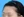 โบท็อกซ์หว่างคิ้ว — ก่อนทำ · คังนัมบีบีคลินิก
