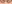 裏ハムラ法（経結膜的眼窩脂肪移動術） — ファクト美容外科クリニック
