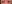 さかさまつげ手術（睫毛内反症・眼瞼内反症の手術） — オロ美容外科クリニック