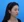 Ultracol (PDO microsphere collagen stimulator injection) — before · Gangnam BB Clinic