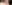 二重まぶた（自然癒着法） — トゥービー美容外科クリニック