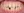 Clippy-C self-ligating ceramic braces (TOMY) — before (341days) · Yonsei Good Day Dental Clinic - Suseo Branch