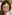 裏ハムラ法（経結膜的眼窩脂肪移動術） — リンク美容外科クリニック