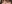 二重まぶた（自然癒着法） — ルホ美容外科クリニック