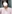 二重あごの脂肪吸引（顎下脂肪吸引） — ドクター・ジョン リバンクリニック