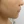 Surfect Lifting (4MHz monopolar RF lifting) — after (90days) · Only Lift Clinic
