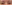 眉毛挙上術（ブロウリフト） — エイペックス美容外科クリニック