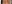 裏ハムラ法（経結膜的眼窩脂肪移動術） — プレジャー美容外科クリニック