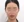皮質骨切除術（下顎外板骨切り） — 術前 (90日) · アイルミ美容外科クリニック