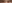 二重まぶた（自然癒着法） — タンキュー美容外科クリニック