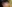額縮小術（生え際下げ・ヘアライン下降術） — ザフィックス美容外科クリニック