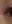 二重まぶた（自然癒着法） — クレア美容外科クリニック